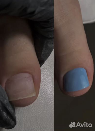 Маникюр/педикюр