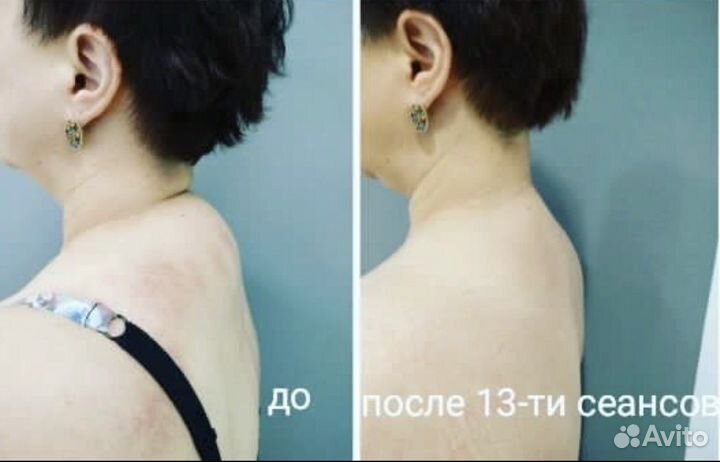 Массаж Кудрово Оккервиль
