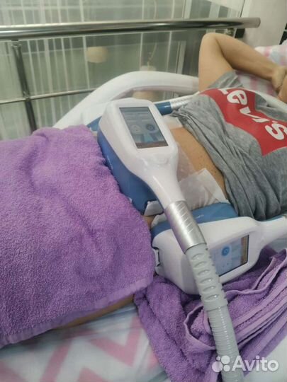 Криолиполиз процедура