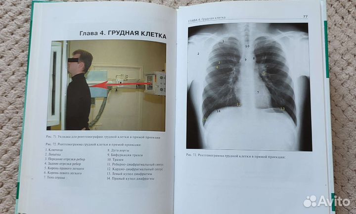 Краткий атлас по рентгенографии