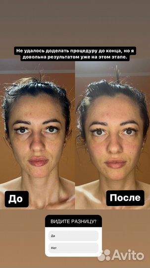 Массаж лица