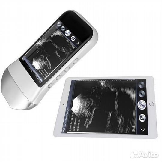 Узи аппарат ручной sonostar XProbe-5N