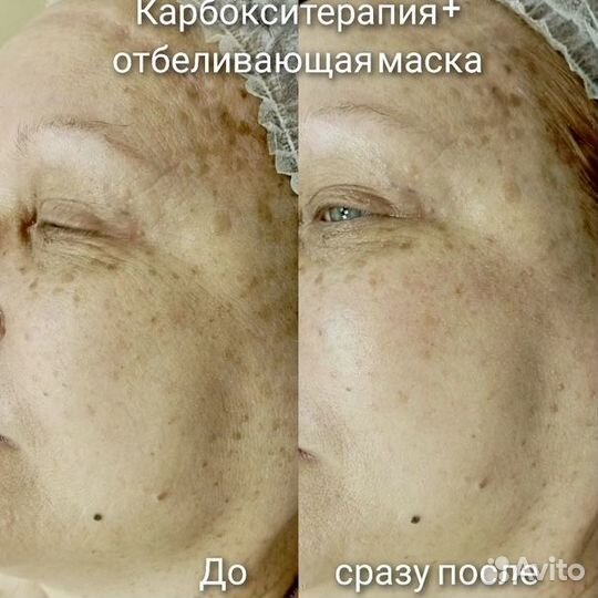 Маникюр, педикюр, депиляция, косметолог, подолог