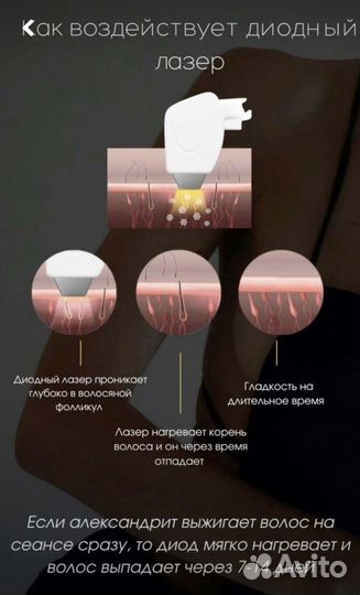 Эпиляция лазерная