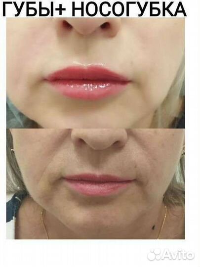 Услуги косметолога