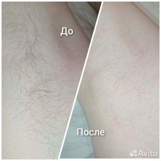 Шугаринг женский/мужской