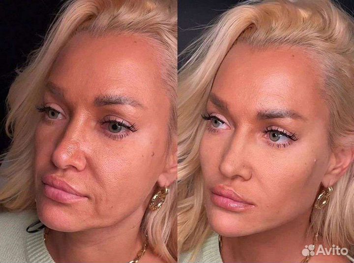 Услуги косметолога