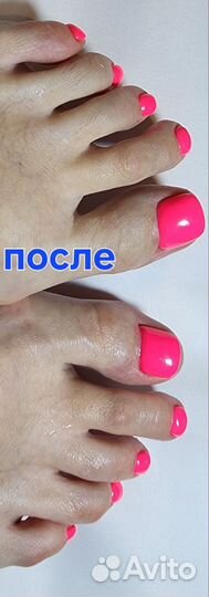 Маникюр,Подолог, мед педикюр, титановая нить