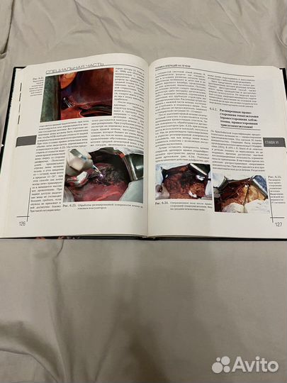 Патютко Хирургическое лечение опухолей печени