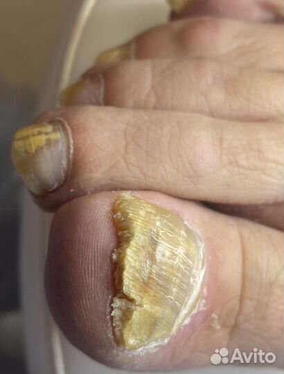 Услуги подолога