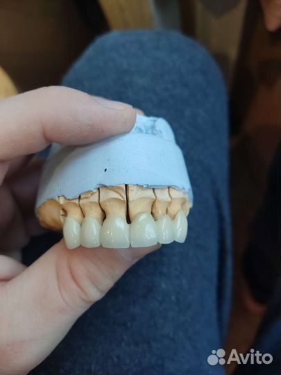 Зубной техник керамист