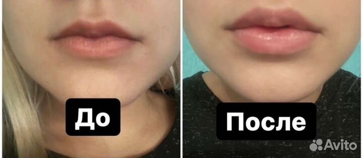 Блеск увеличивающий объем губ