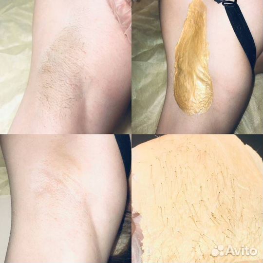 Шугаринг депиляция