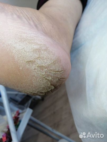 Smart педикюр.Педикюр,маникюр мужской и женский