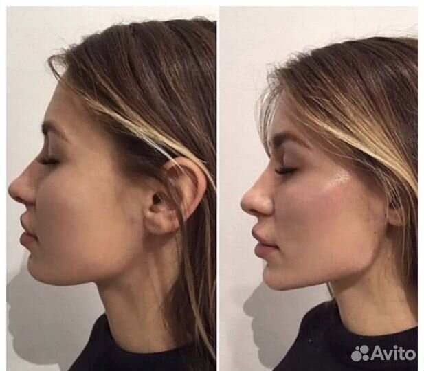 Косметолог лицо под ключ