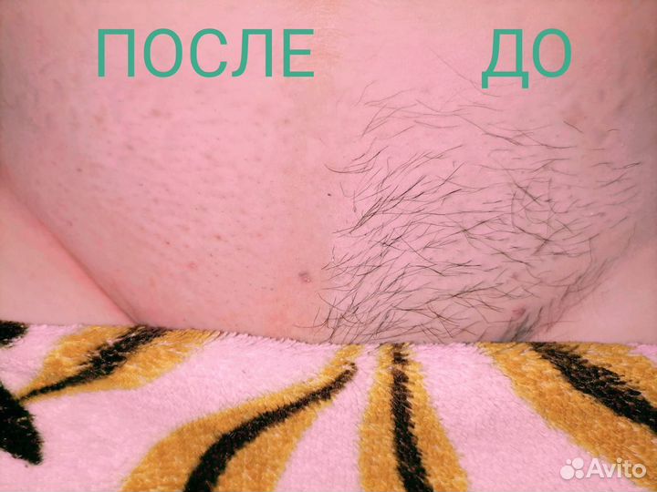 Шугаринг сахарная депиляция