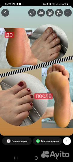 Аппаратный педикюр