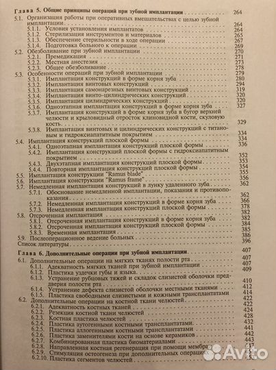 Имплантация зубов