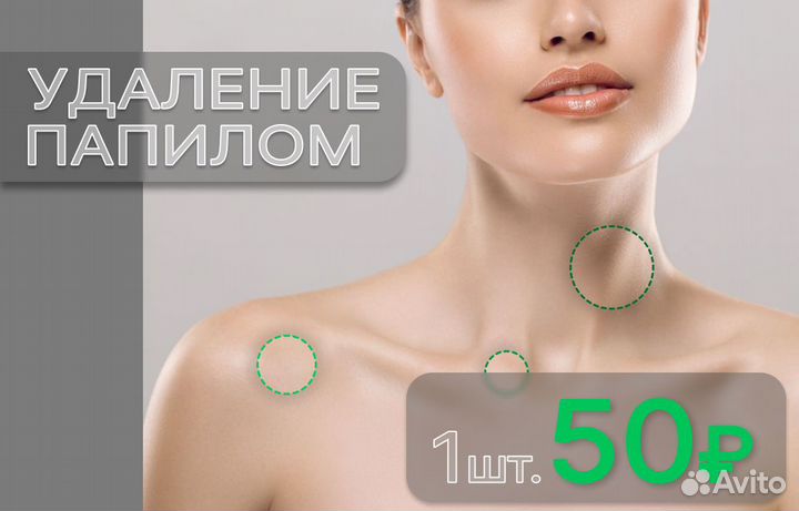 Удаление папиллом, шипиц, кератом, жировиков