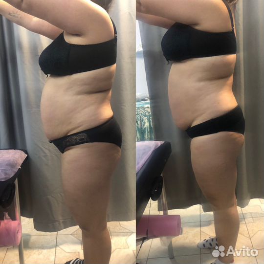 Массаж ручной/аппаратный/массаж лица