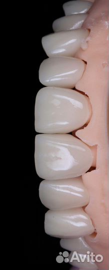 Коронки цирконевые, виниры, зубы на имплантах