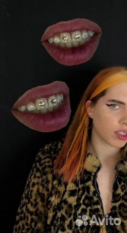 Установка скайсов