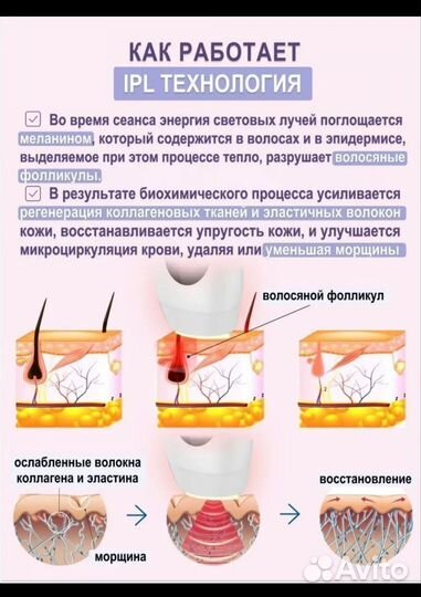 Фотоэпилятор braun