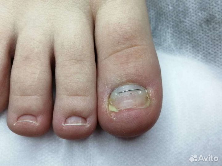 Услуги подолога