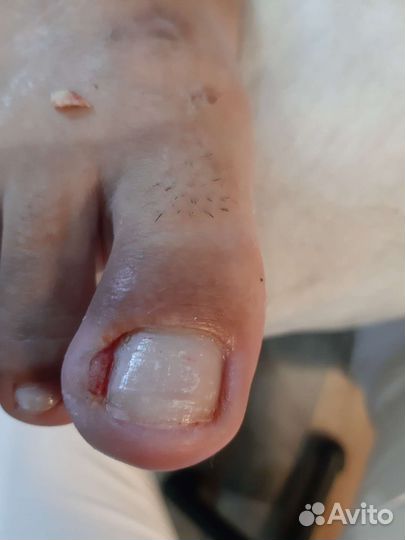 Подолог Педикюр Маникюр