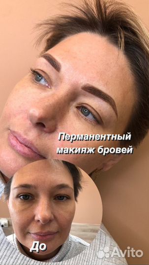 Брови