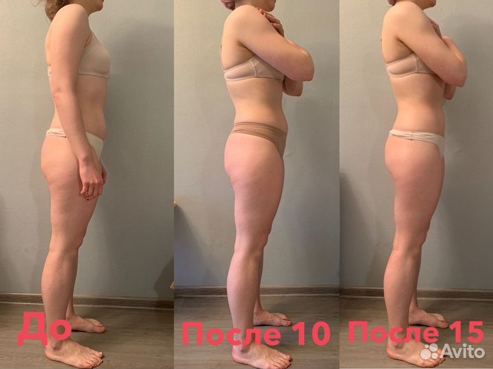 Массаж, массаж лица, RF, кавитация, лазерный липол