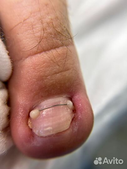 Маникюр, педикюр, подология