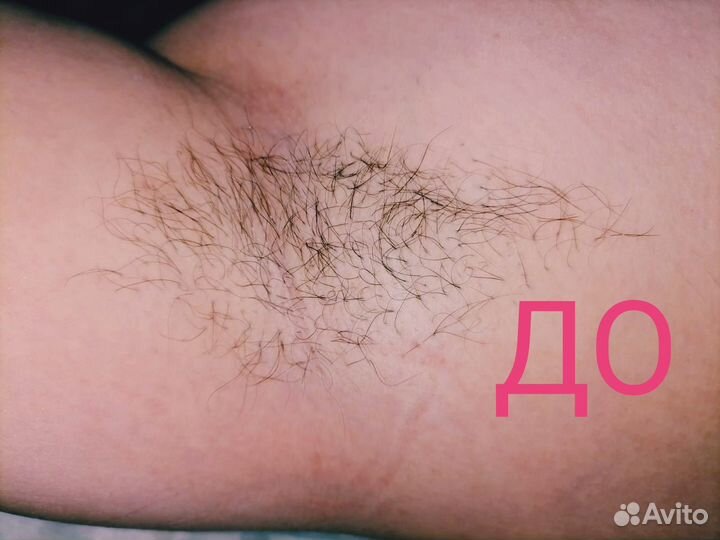 Шугаринг сахарная депиляция