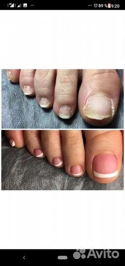 Педикюр любой сложности