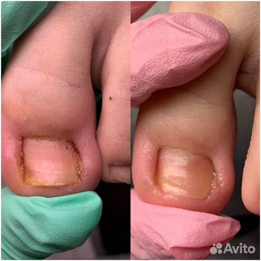 Подолог/медицинский педикюр