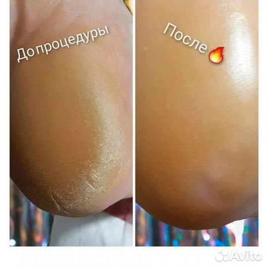 Педикюр мужской, женский, маникюр