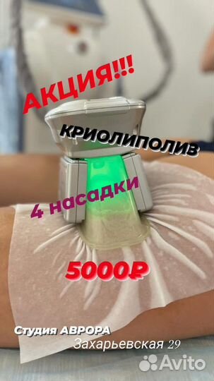 Lpg массаж, криолиполиз, коррекция фигуры