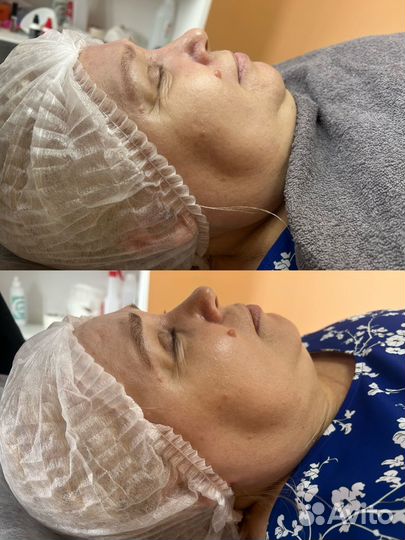 Услуги косметолога