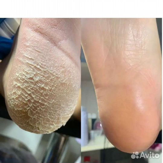 Педикюр мужской, женский, маникюр