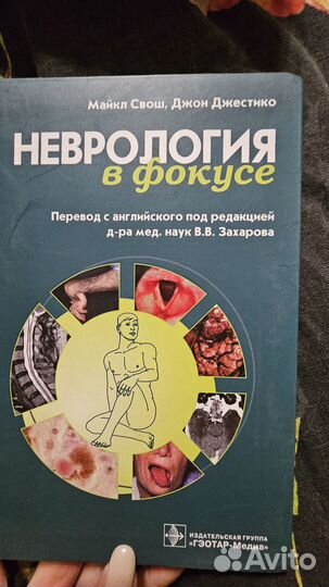 Неврология в фокусе