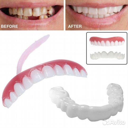 Виниры для зубов Snapon Smile