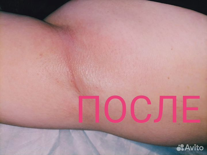 Шугаринг сахарная депиляция