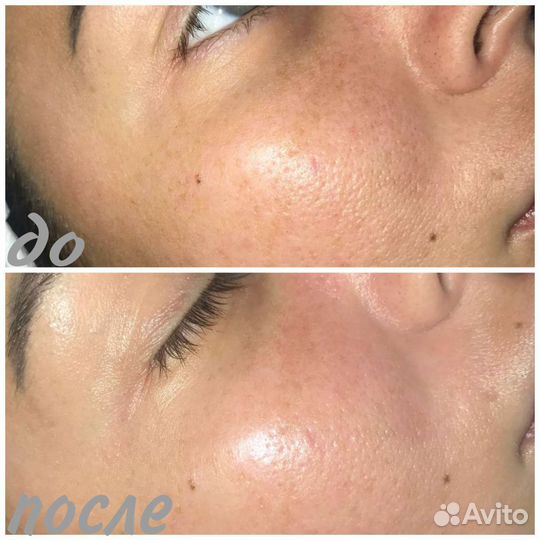 Услуги косметолога-эстетиста