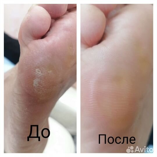 Маникюр и педикюр