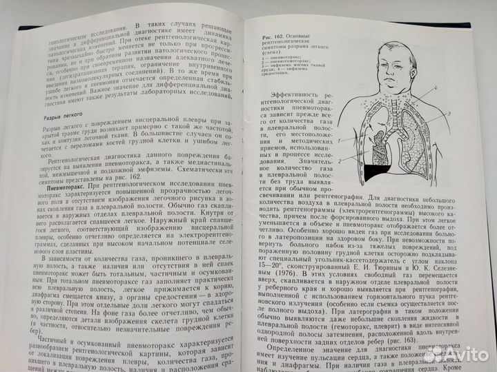 Книга Неотложная рентгенодиагностика Кишковский