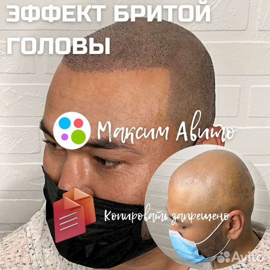 Трихопигментация головы