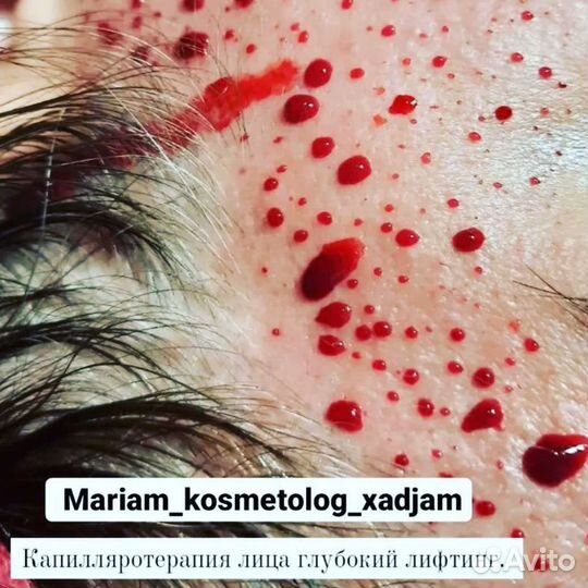 Косметолог хаджам