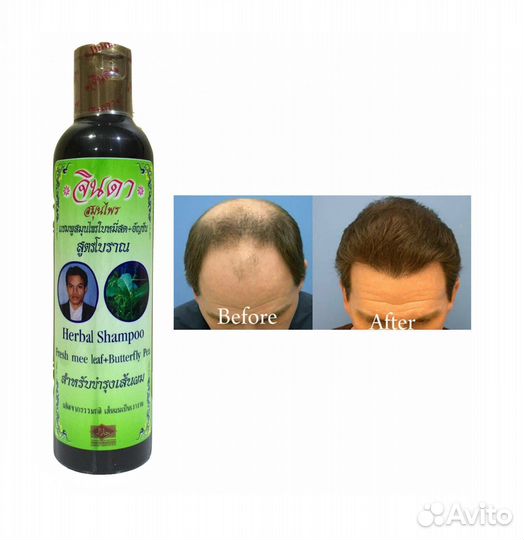 Травяной шампунь Джинда (Jinda Herbal Shampoo) 250