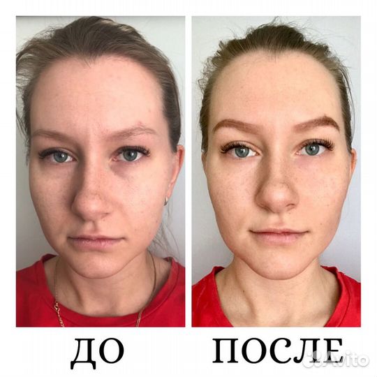Лечебный массаж