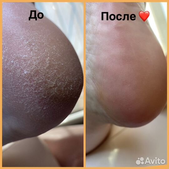 Маникюр, педикюр от опытного мастера